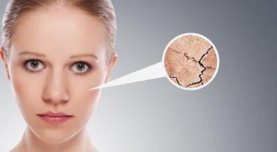 Causes of peeling skin on the face in women