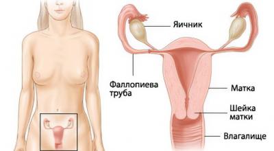 Consecuencias de la ligadura de trompas durante la cesárea